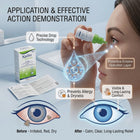 Xailin Ectoin Eye Drops for Dry, Sensitive & Allergy-Prone Eyes